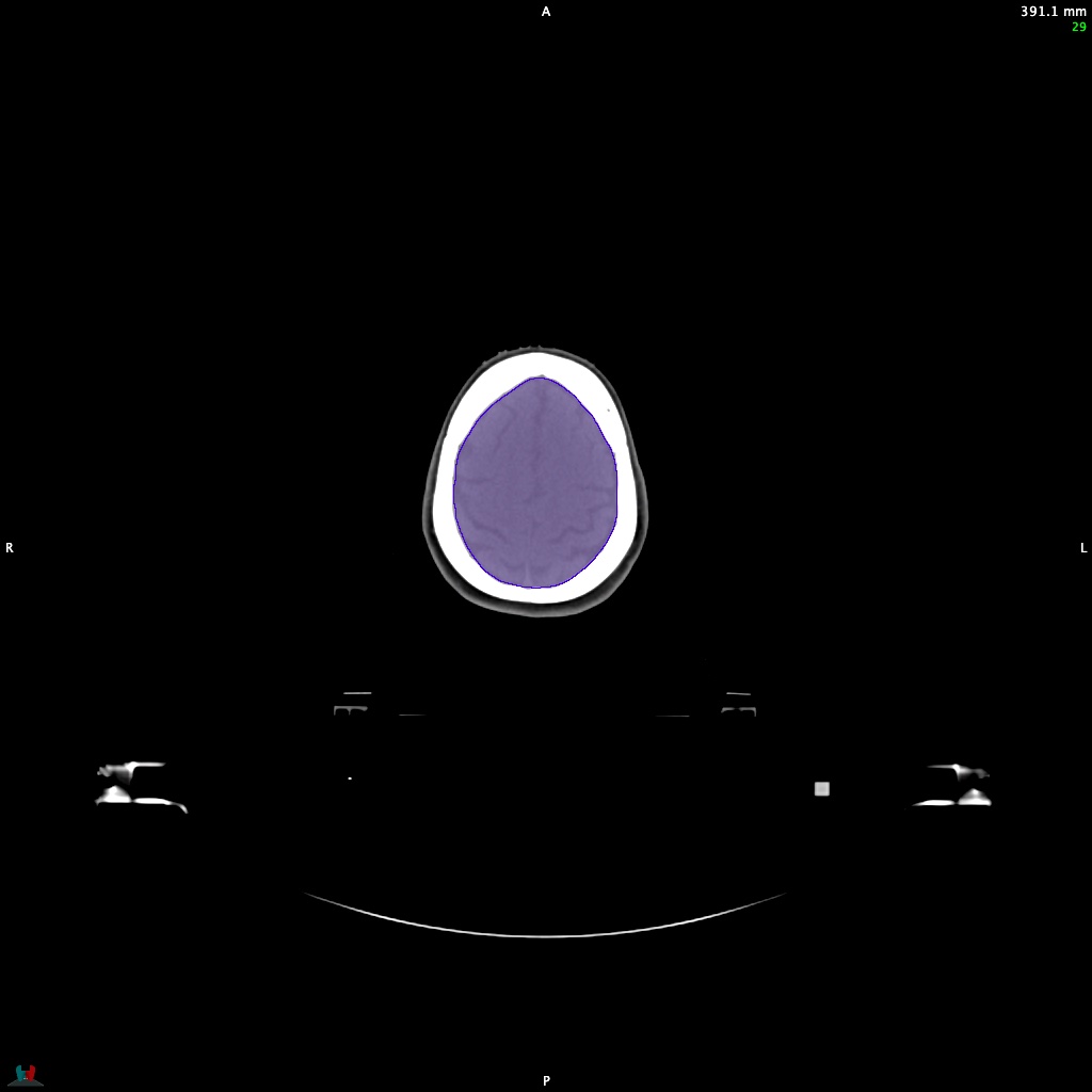 Automatic Contouring/Segmentation Demo