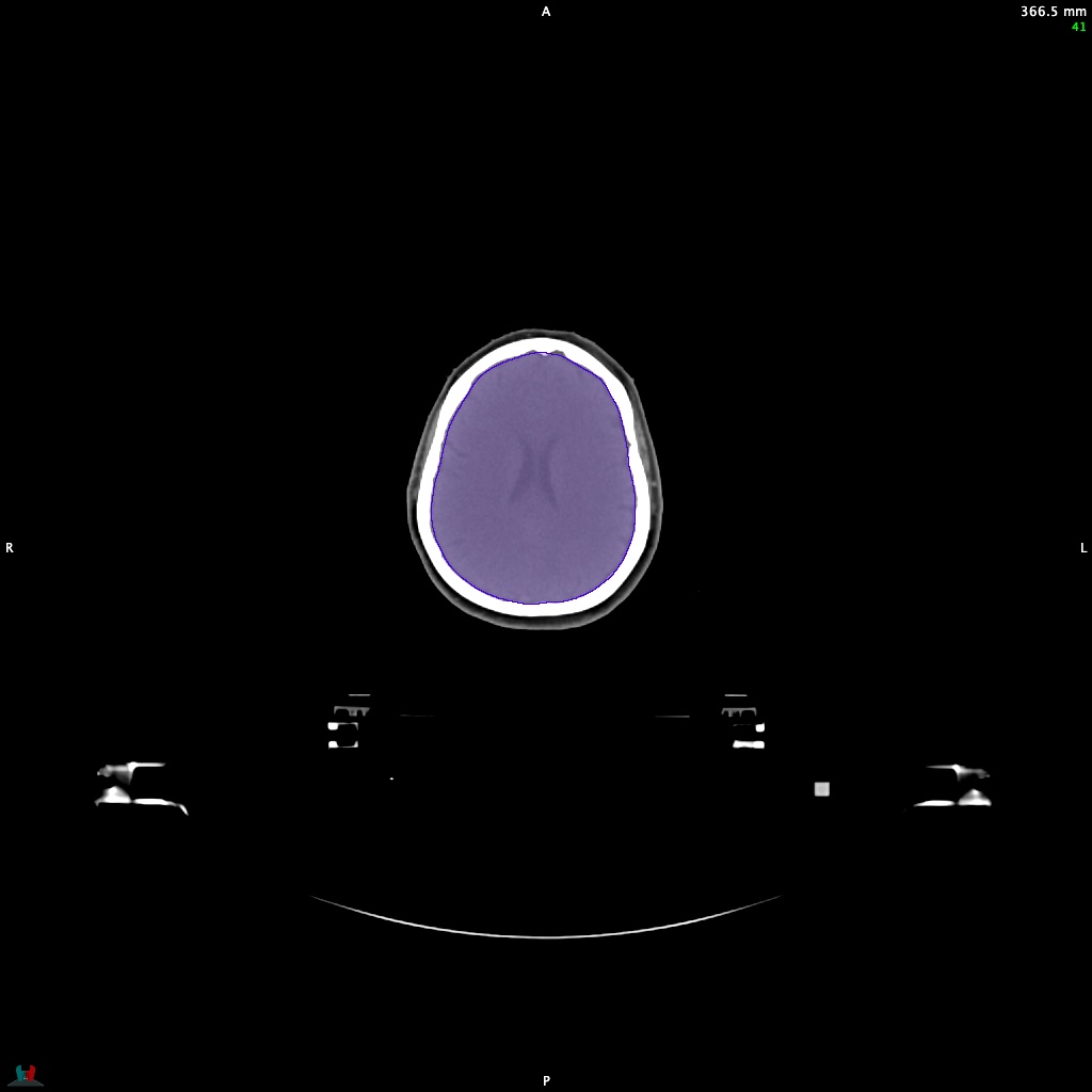 Automatic Contouring/Segmentation Demo