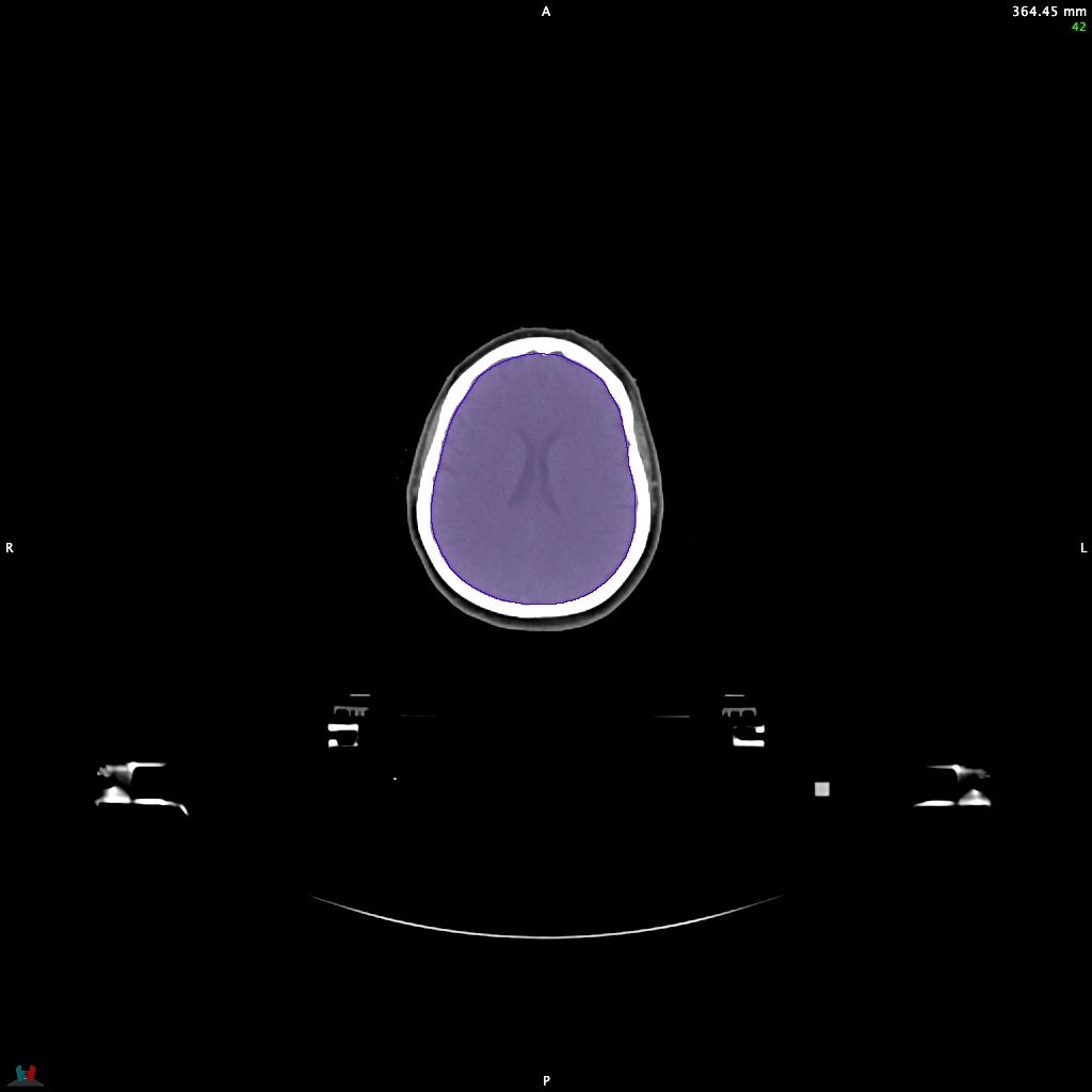 Automatic Contouring/Segmentation Demo