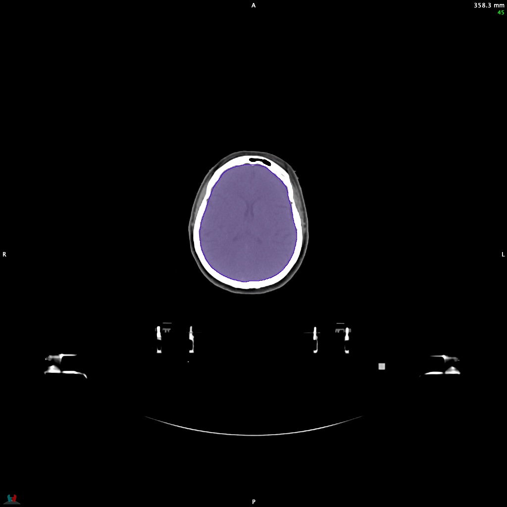 Automatic Contouring/Segmentation Demo