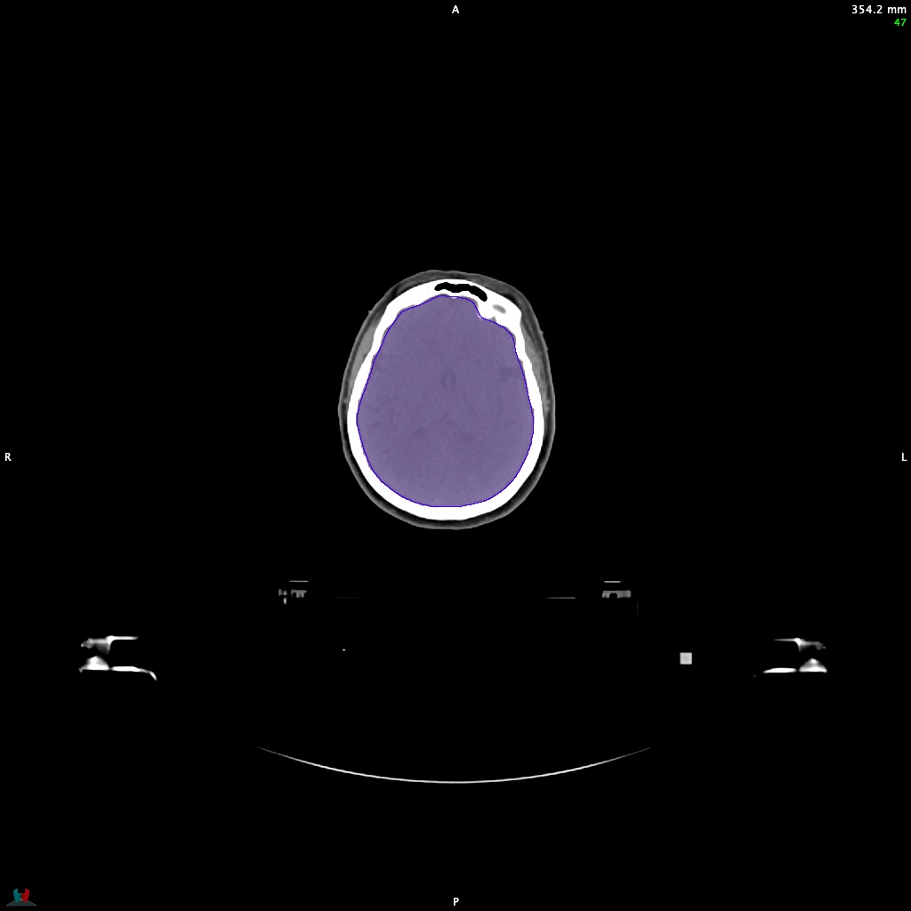 Automatic Contouring/Segmentation Demo