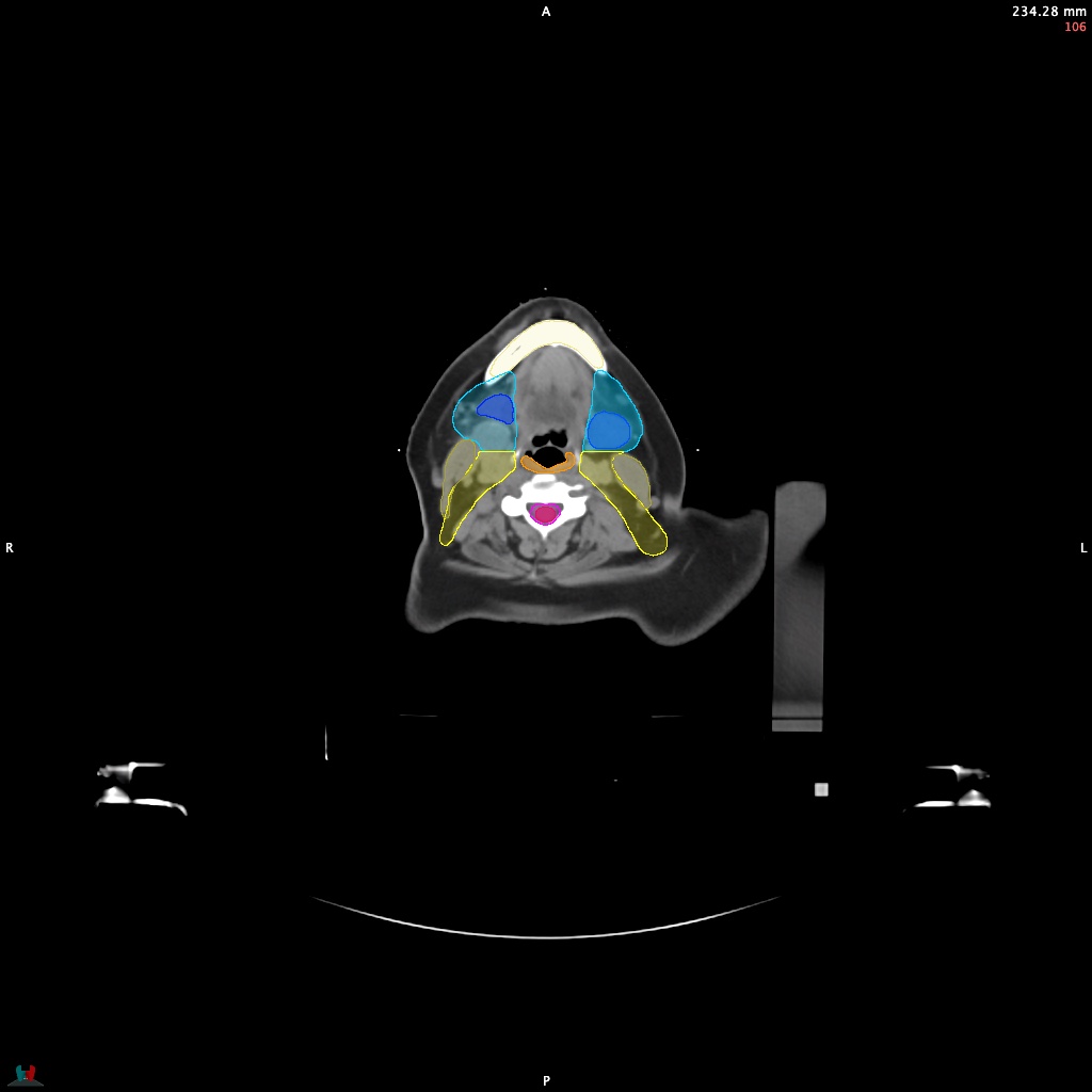 Automatic Contouring/Segmentation Demo