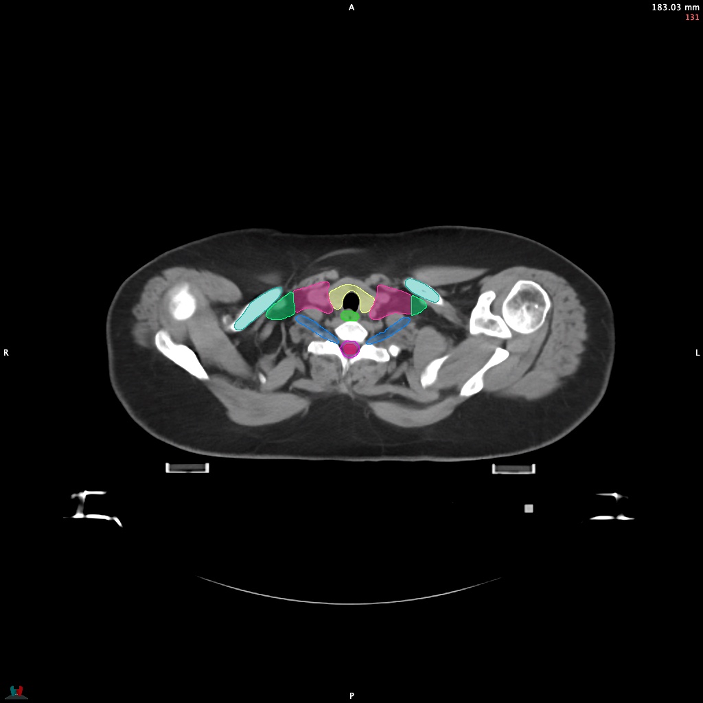 Automatic Contouring/Segmentation Demo