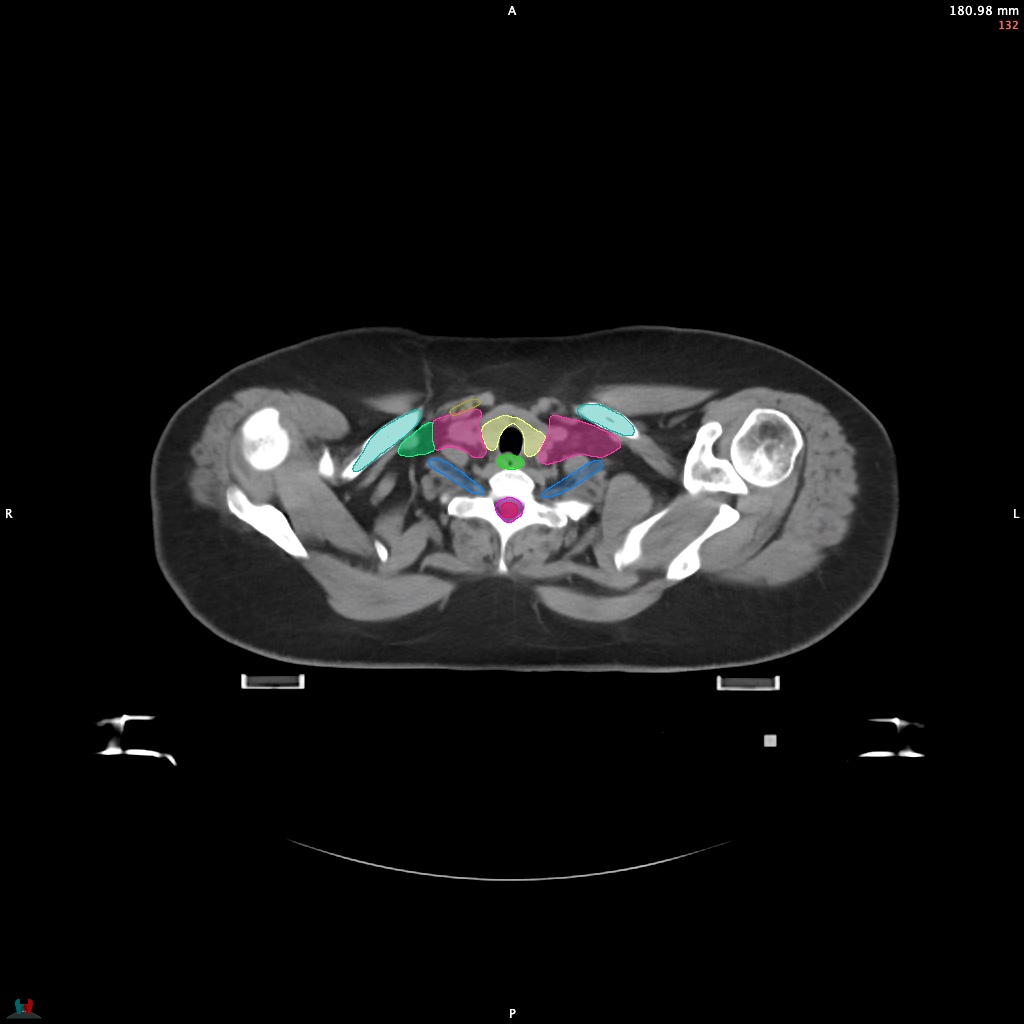 Automatic Contouring/Segmentation Demo